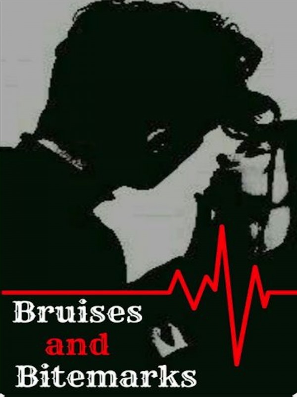 Bruises and Bitemarks
