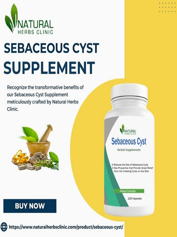 Sebaceous Cyst Supplement Book